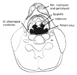 Vallecula Epiglottica