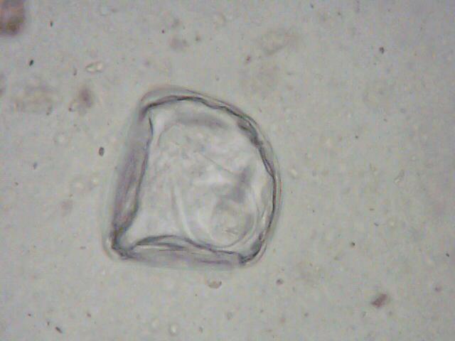 Anoplocephala Egg