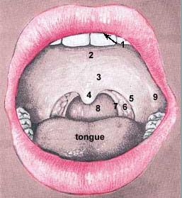 Parotid Opening