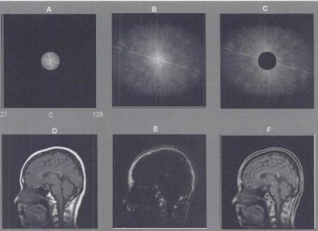 mri-k-space-quiz-proprofs-quiz