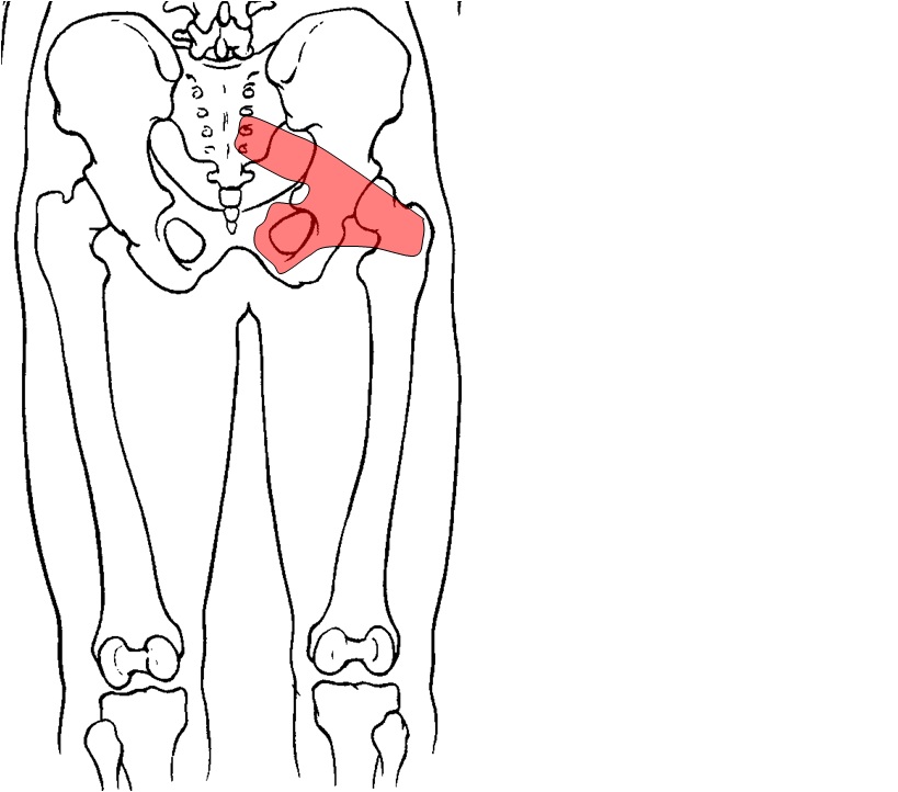 Anatomy Hip Joint Muscles - ProProfs Quiz