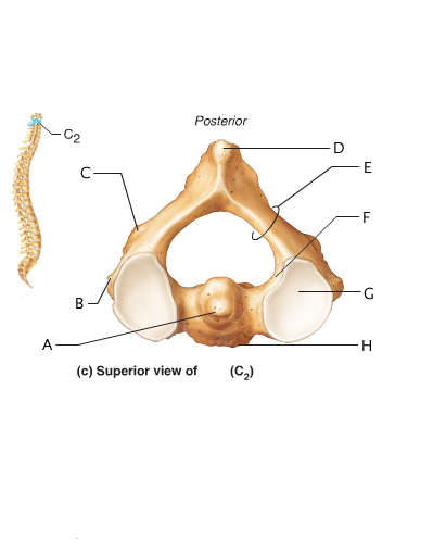 Anatomy And Physiology 141 Lab Practical 2 - ProProfs Quiz