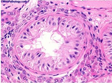 Block 15 Prostate Penis Scrotum Disorders - ProProfs Quiz