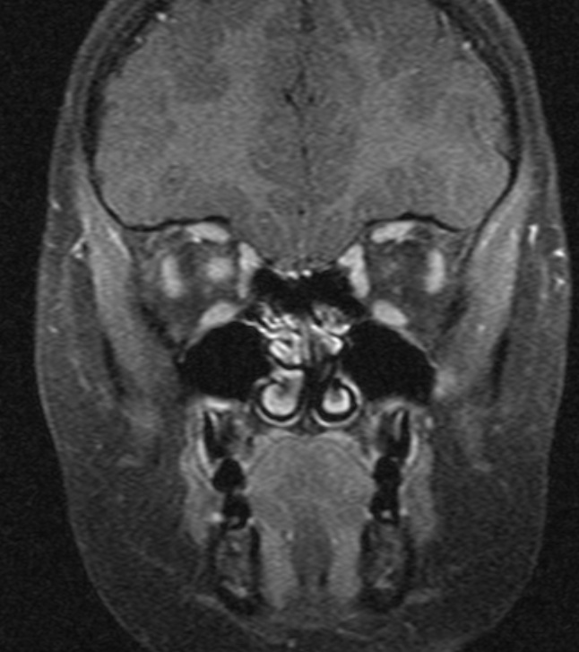 Radiology Quiz ProProfs Quiz