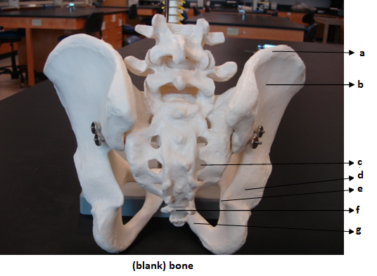 Bones - ProProfs Quiz