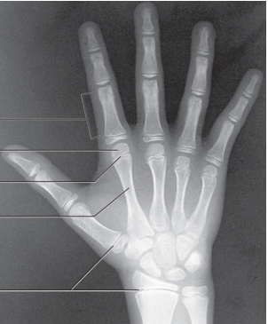 The Osteon Or Haversian System Quiz Questions - Trivia & Questions