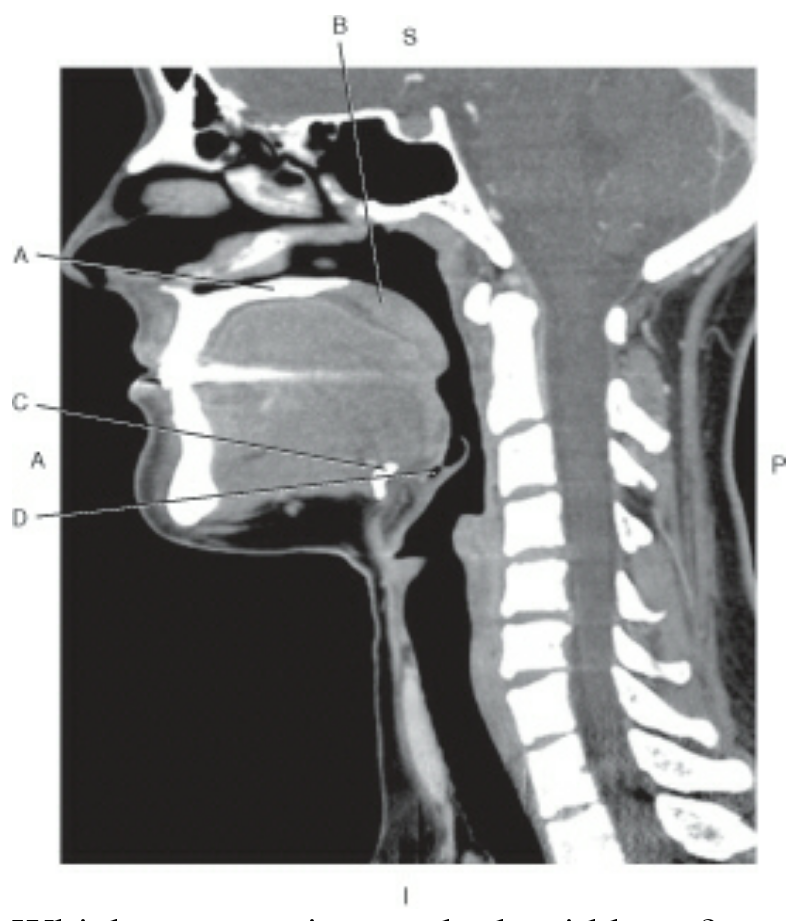 Identify Arrow Point Of MRI! - ProProfs Quiz