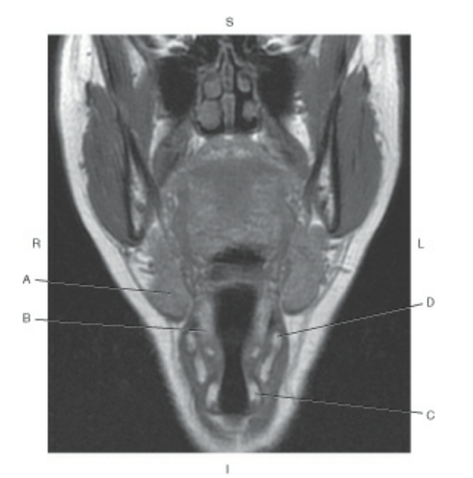 Identify Arrow Point Of MRI! - Quiz, Trivia & Questions