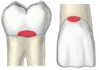 Dental Charting And Terminology Trivia Quiz - Trivia & Questions