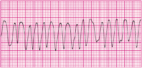 ACLS Practice Test - ProProfs Quiz