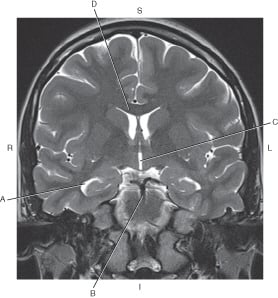 function of the ventricles of the brain - Quiz, Trivia & Questions