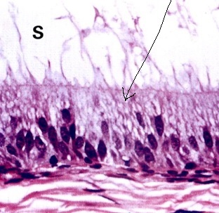 BIOL 302 Epithelium Characterization Quiz | Attempts: 347 - Trivia ...