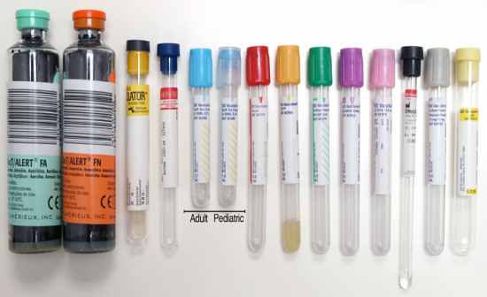 PHLEBOTOMY COLLECTION TUBES Flashcards by ProProfs