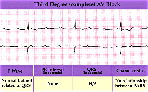 EMT-cardiology Flashcards by ProProfs