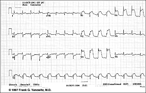 Principles Of Cardiology III- Test I - Quiz, Trivia & Questions