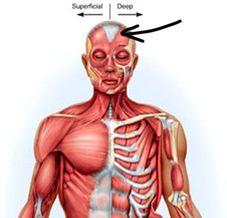 Name The Muscle Practical Quiz | Attempts: 6694 - Trivia & Questions