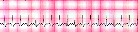 EKG Final Examination(2) - ProProfs Quiz