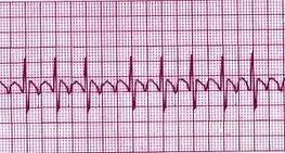 Cardiac Nursing Pre/Post Test | Attempts: 12589 - Quiz, Trivia & Questions