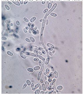 Гарднерелла соскоб. Гарднереллы (Gardnerella vaginalis). Gardnerella vaginalis полукачественный. Гарднареллы под микроскопом.