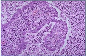 Pathology maladies reproductive system histology