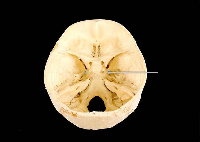 Skeletal Exam Study Guide | Attempts: 2299 - Quiz, Trivia & Questions