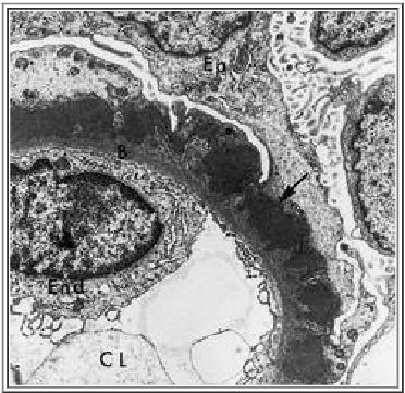 Pathology Review Ch 6 Diseases Of Immunity Pt 1 - ProProfs Quiz