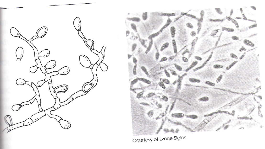 Identify The Fungus - ProProfs Quiz