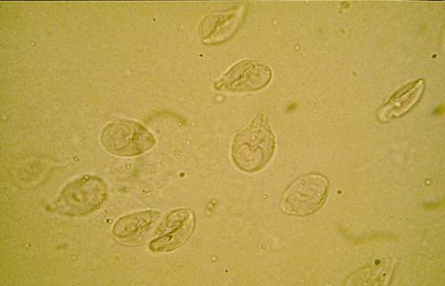 Parasite Identification | Attempts: 4241 - Quiz, Trivia & Questions