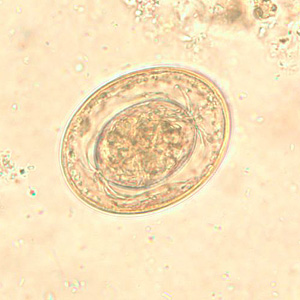 Do You Know About Parasitology? | Attempts: 3123 - Quiz, Trivia & Questions