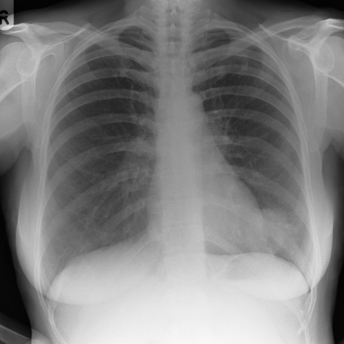 Respiratory Quiz - ProProfs Quiz