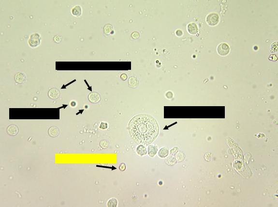 Hematology & Urinalysis - ProProfs Quiz