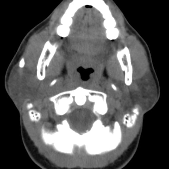 Radiology Flashcards