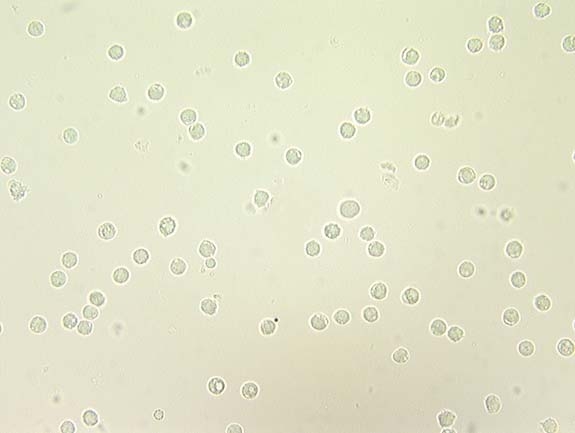 Hematology & Urinalysis - Proprofs Quiz