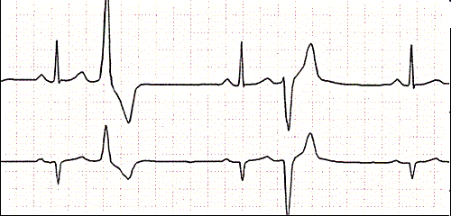 Week 2 Quiz EKG Surg Set Up | Attempts: 205 - Trivia & Questions