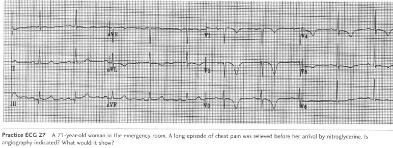 Practice EKGs - ProProfs Quiz