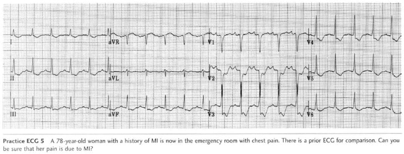 Practice EKGs - ProProfs Quiz