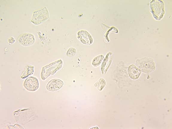 Hematology & Urinalysis - ProProfs Quiz